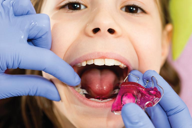 ¿Ortopedia dentofacial?