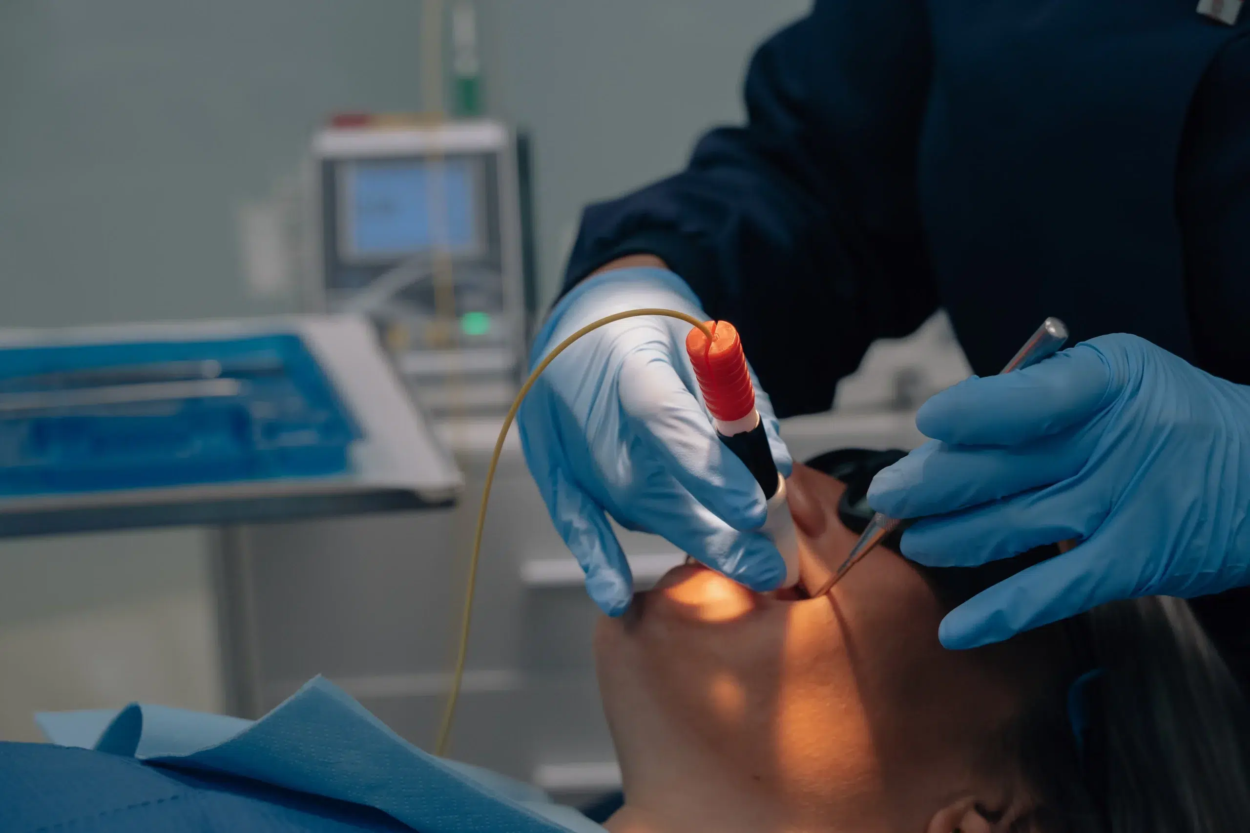 sonrisa gingival zaragoza
