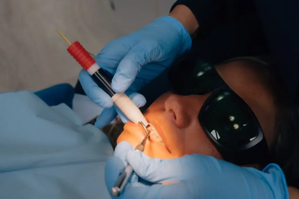 sonrisa gingival zaragoza