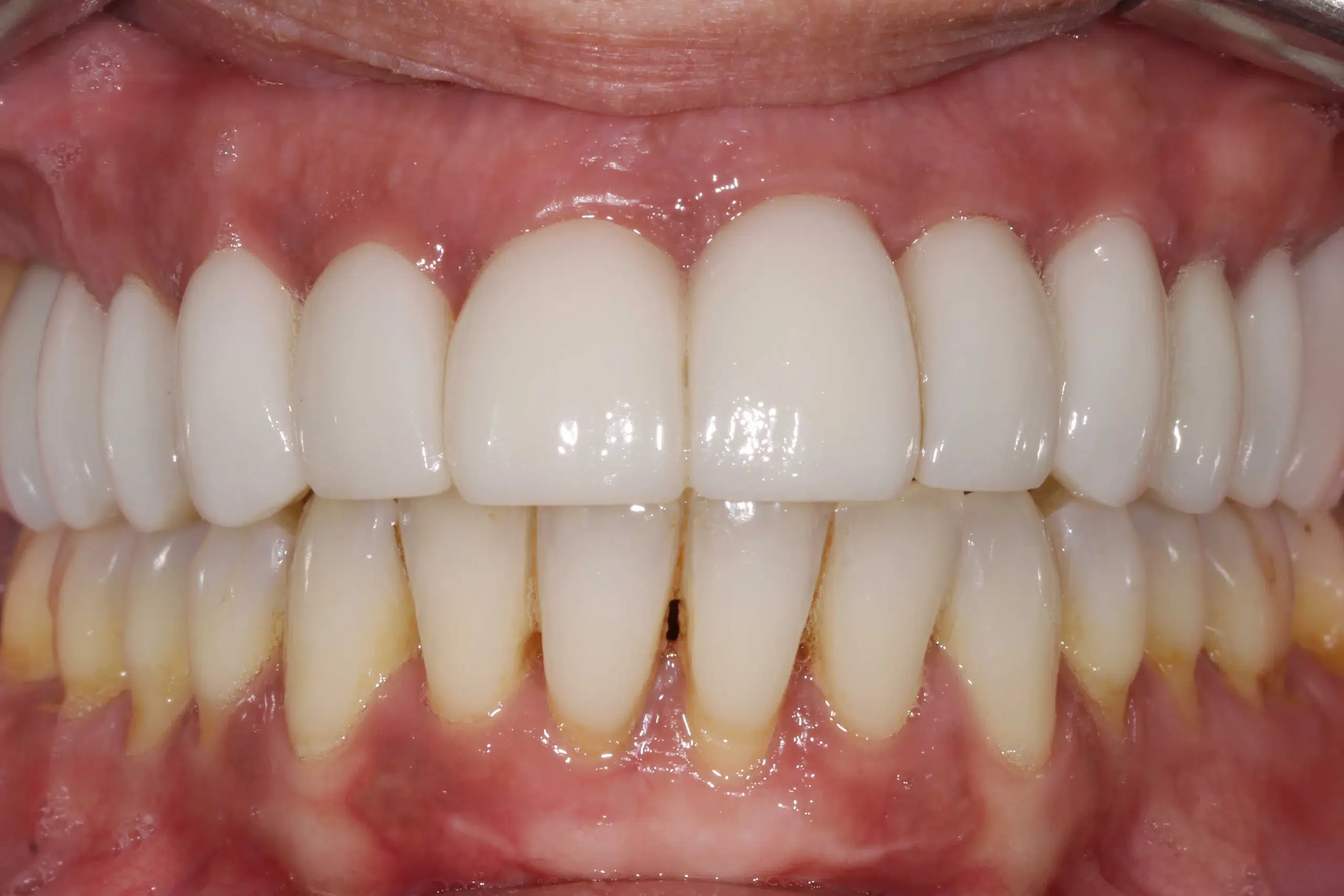 clinica dental zaragoza