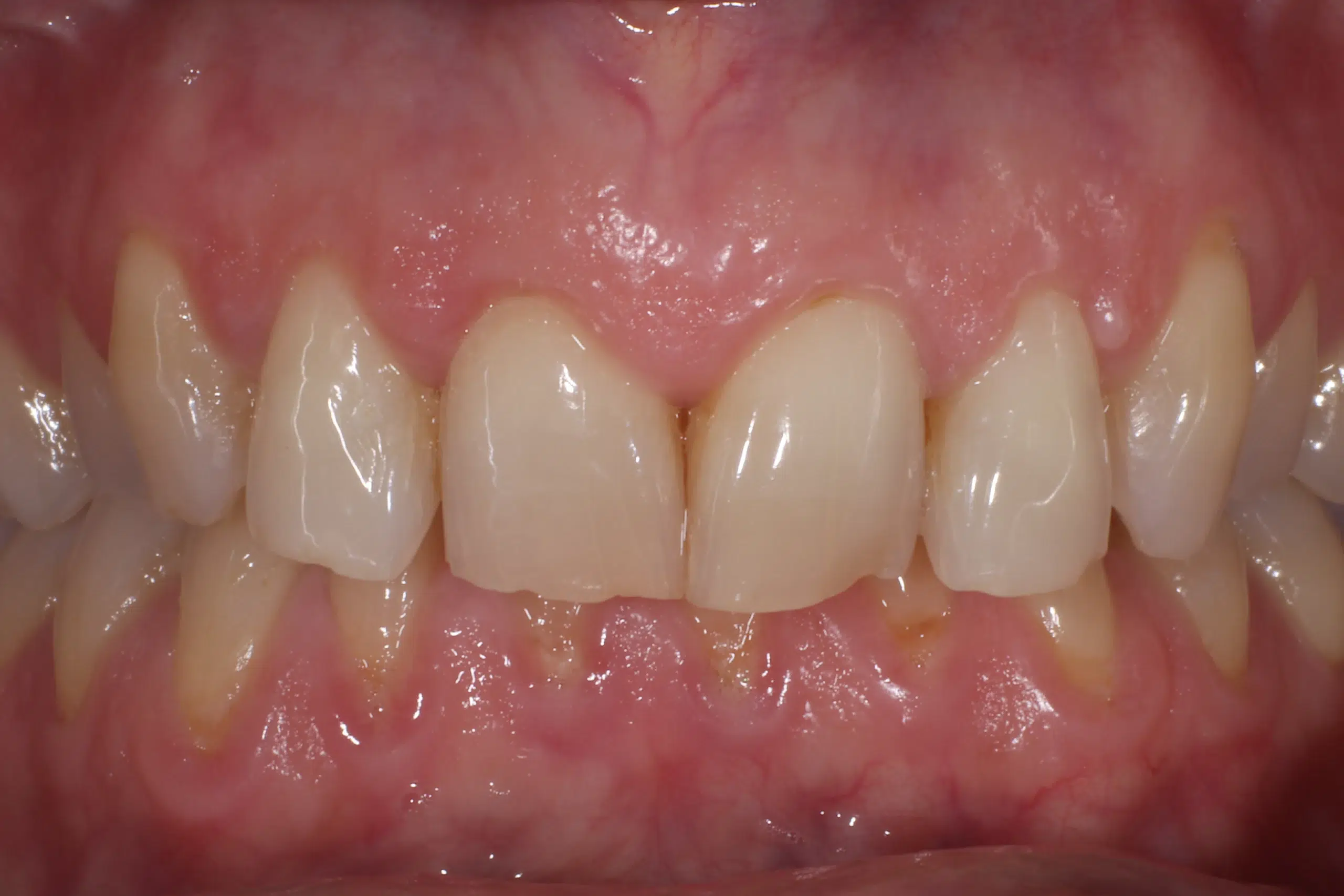 clinica dental zaragoza