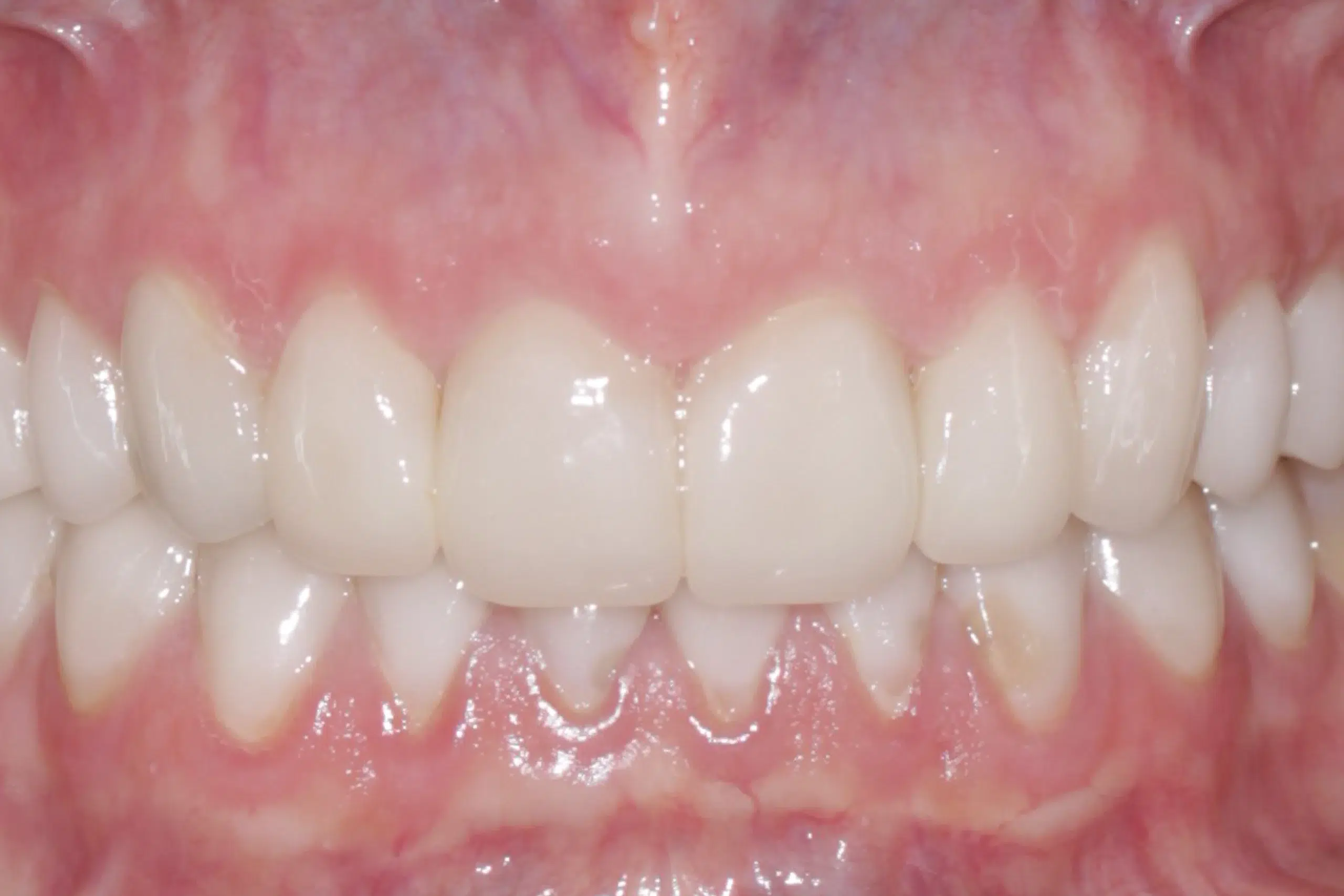 clinica dental zaragoza